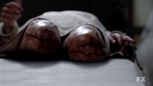 American Horror Story – 2x04 I Am Anne Frank (Part 1)