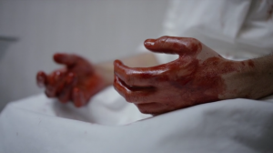 The Knick – 1x04/05 Where’s the Dignity & They Capture the Heat